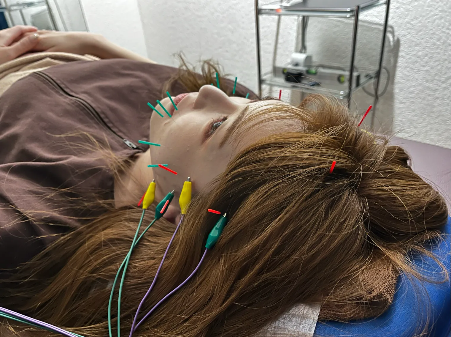 ②針に微弱電流を流していきます