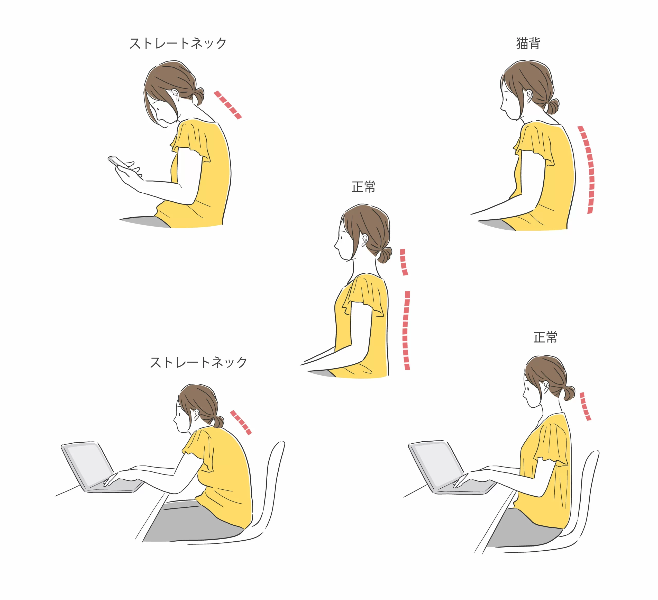 ストレートネックを引き起こす原因